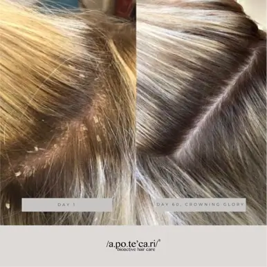 Apotecari Crowning Glory 60 Day Bottle | Perfected Scalp Health & Balanced Hydration