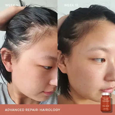 Vida Glow Hairology Advanced Repair 30 Capsules