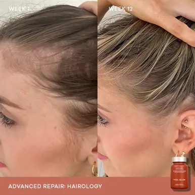 Vida Glow Hairology Advanced Repair 30 Capsules