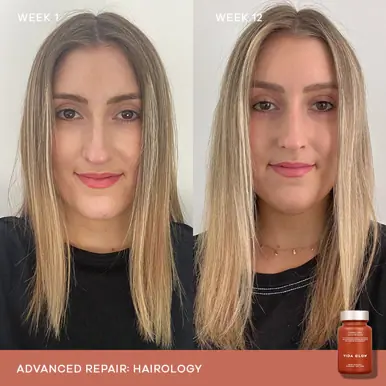 Vida Glow Hairology Advanced Repair 30 Capsules