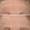 Murad Retinal Resculpt Overnight Treatment