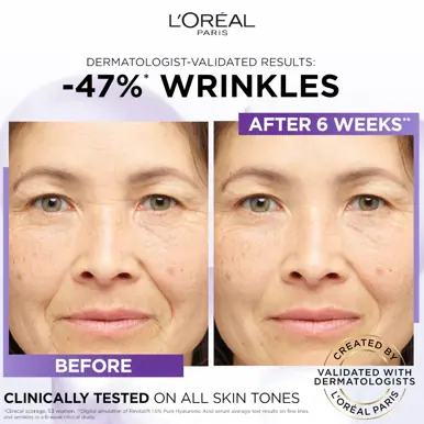 L'Oréal Paris Revitalift Filler 1.5% Pure Hyaluronic Acid Anti-Wrinkle Serum 30ml
