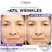 L'Oréal Paris Revitalift Filler 1.5% Pure Hyaluronic Acid Anti-Wrinkle Serum 30ml