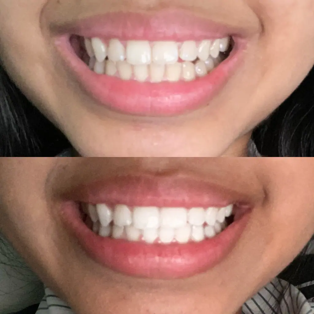 Gem Whitening Pen