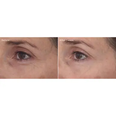 Murad Retinal ReSculpt Eye Treatment