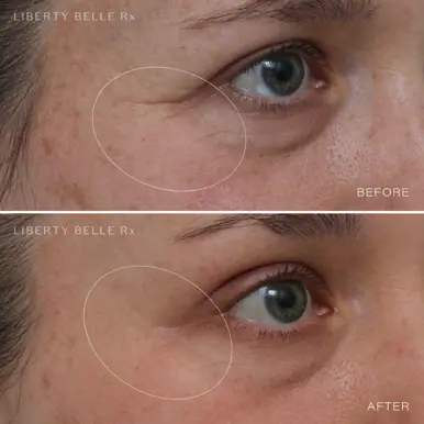 Liberty Belle Rx by Dr Moss EYE DO® Peptide Wrinkle Defence Eye Gel - 15ml