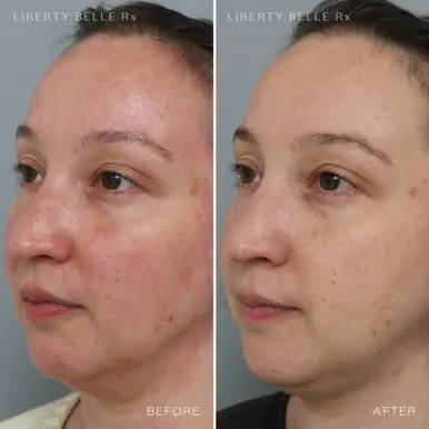 Liberty Belle Rx by Dr Moss POWER BROKER® Anti-Red Wrinkle Defence Cream with Squalane - 50ml