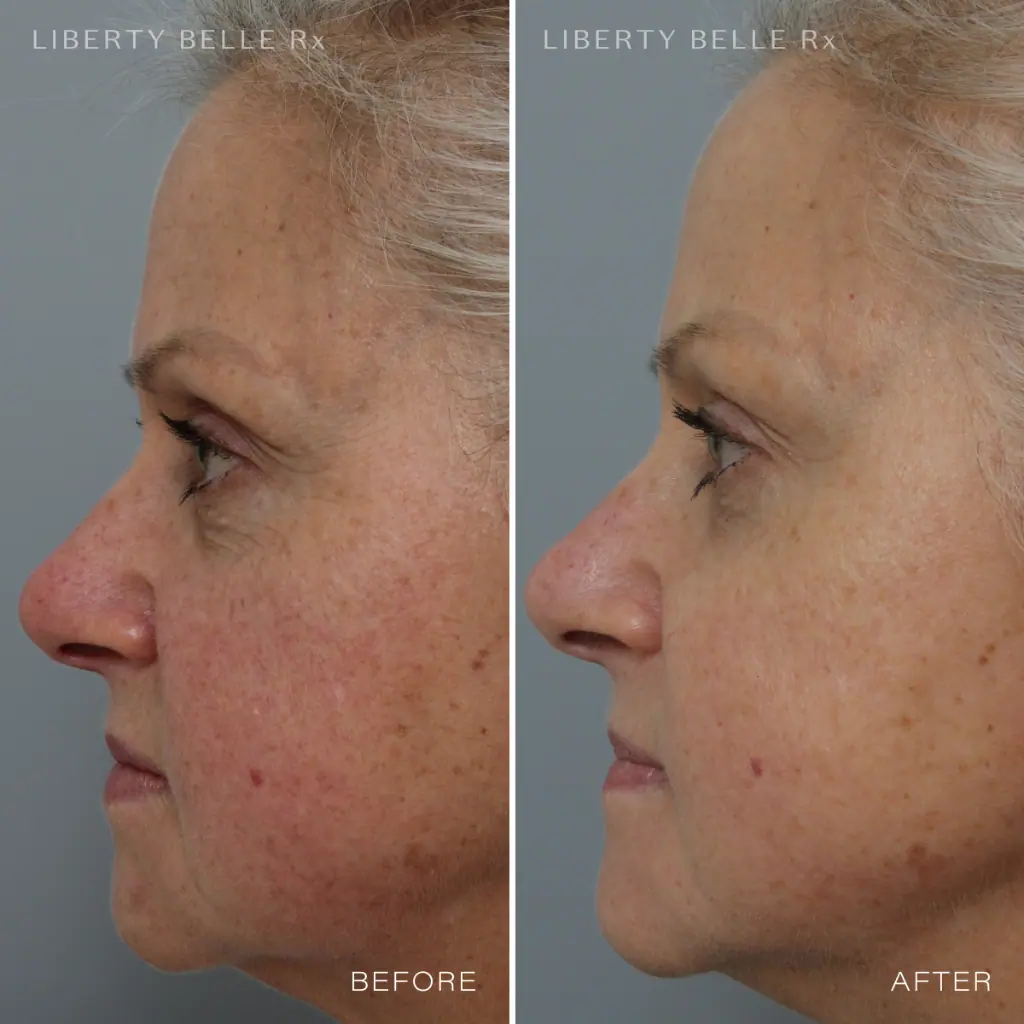 Liberty Belle Rx by Dr Moss STAR QUALITY® Rich Super Anti-Ageing Cream with Bakuchiol - 50ml