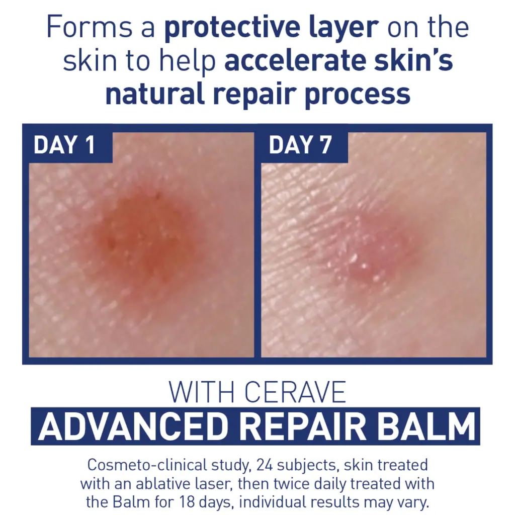 CeraVe Advanced Repair Balm 88ml