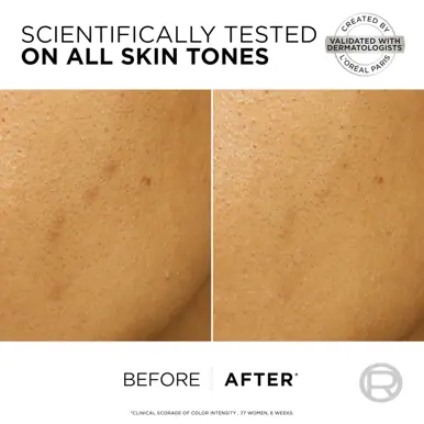 L'Oréal Paris Bright Reveal 25% [AHA + BHA + PHA] + Niacinamide Dark Spot Exfoliant Peel 25ml