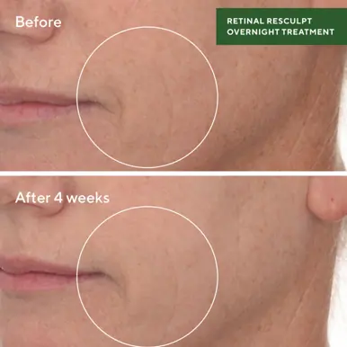 Murad Retinal ReSculpt Overnight Treatment 5ml