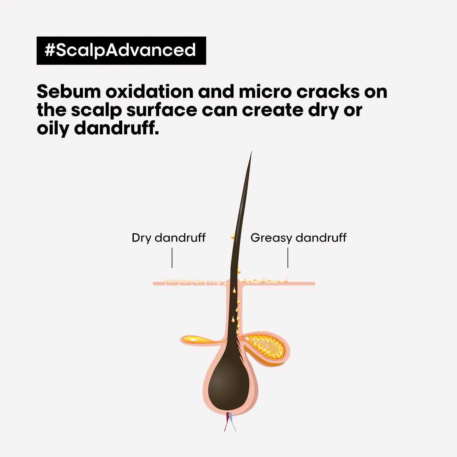 L'Oréal Professionnel Serie Expert Scalp Advanced Anti-Dandruff Shampoo 300ml