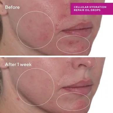 Murad Cellular Hydration Repair Oil Drops