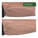 Murad Retinal ReSculpt Body Treatment
