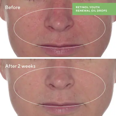 Murad Retinol Youth Renewal Oil Drops
