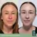 Vida Glow Radiance +