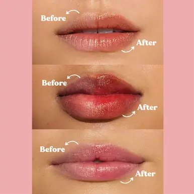 Dermal Therapy Tinted Lip Balm - Rose Pink