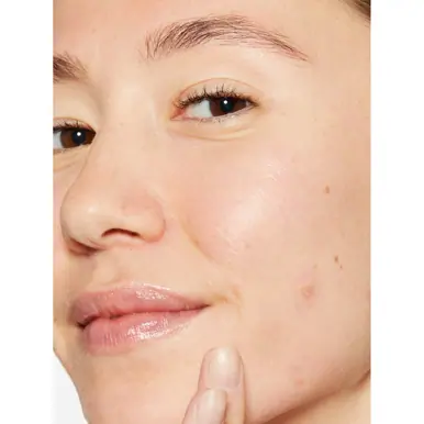 Dermalogica Breakout Biotic Moisturiser