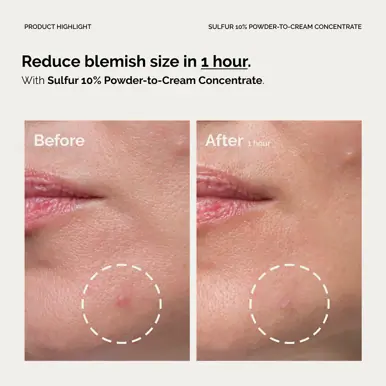 The Ordinary Sulfur 10% Powder-to-Cream Concentrate