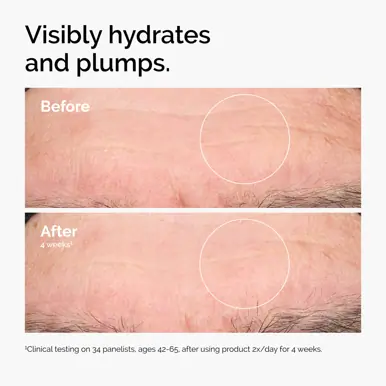 The Ordinary Hyaluronic Acid 2% + B5 - 30ml
