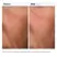The Ordinary Hyaluronic Acid 2% + B5 - 30ml