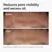 The Ordinary Niacinamide 10% + Zinc 1% - 30ml