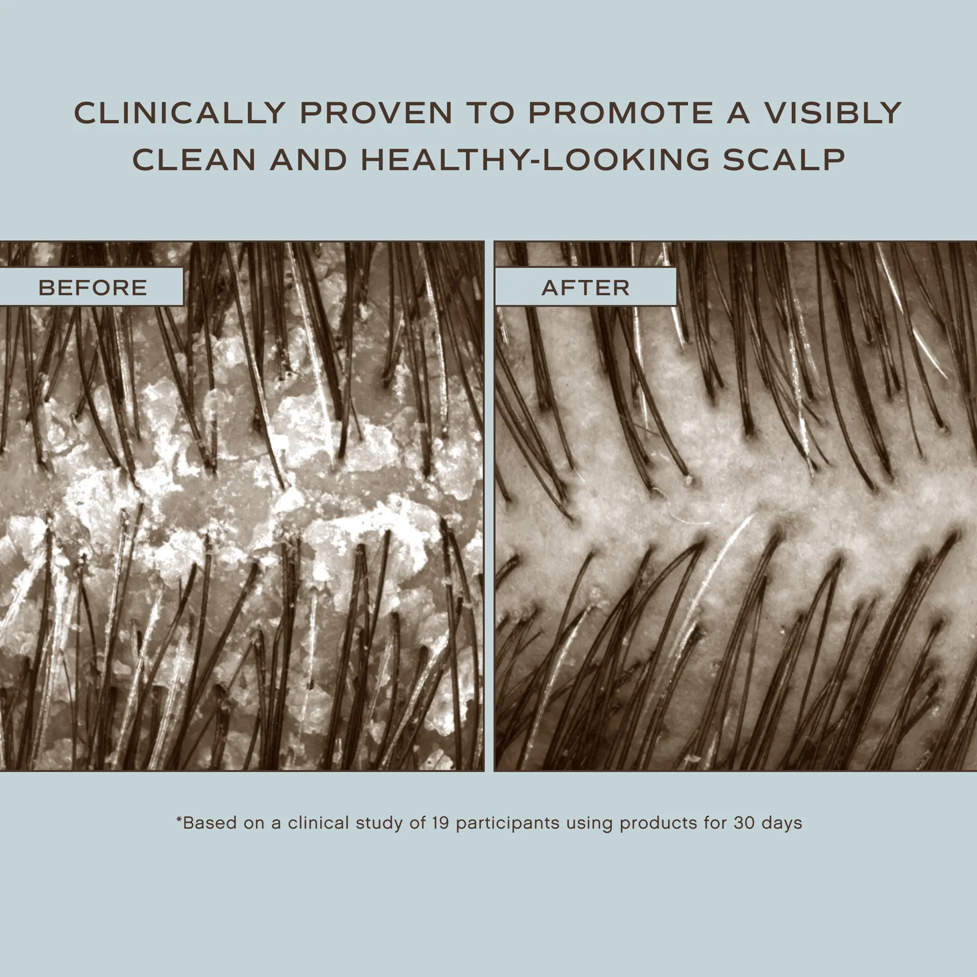 Innersense Organic Beauty Hair Renew Flaky Scalp Shampoo Hairbath 300ml
