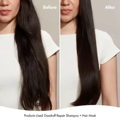 Bondi Boost Dandruff Shampoo - 300ml