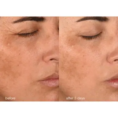 Dermalogica Pro-Collagen Banking Water Cream 50ml
