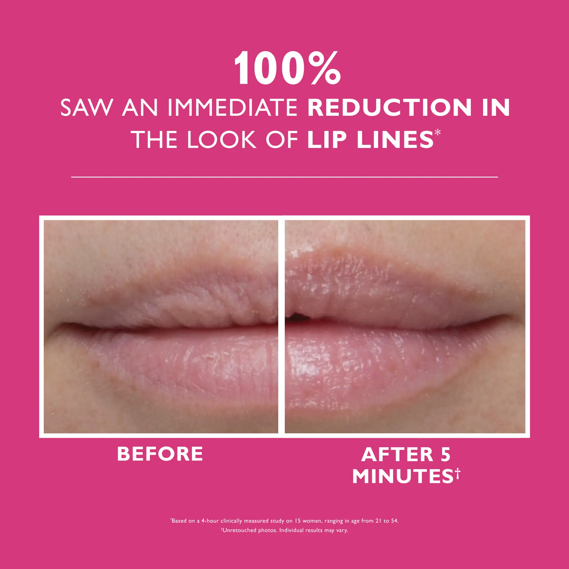 Peter Thomas Roth Instant FIRMxÂ® Lip Filler 10ml