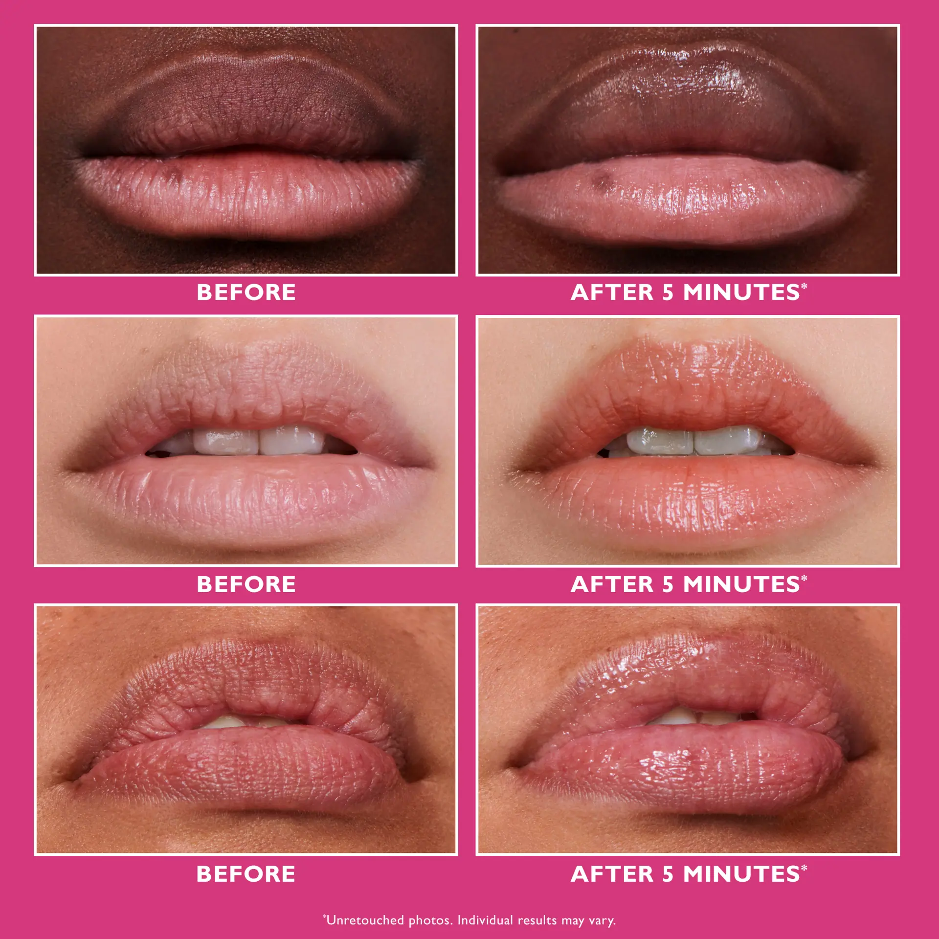 Peter Thomas Roth Instant FIRMxÂ® Lip Filler 10ml