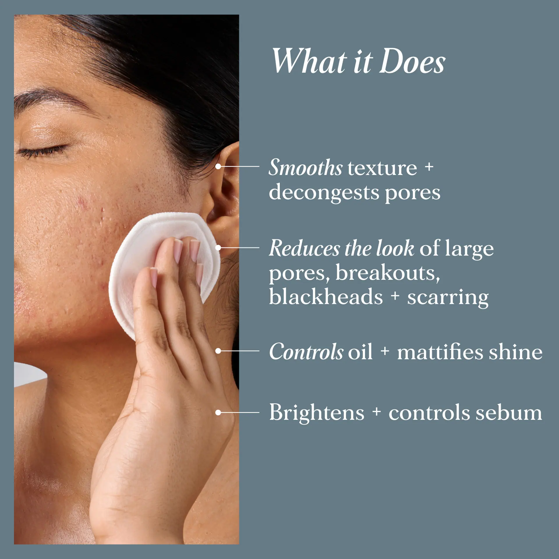 Alpha-H Clear Skin Tonic with 2% Salicylic Acid + Niacinamide 100ml