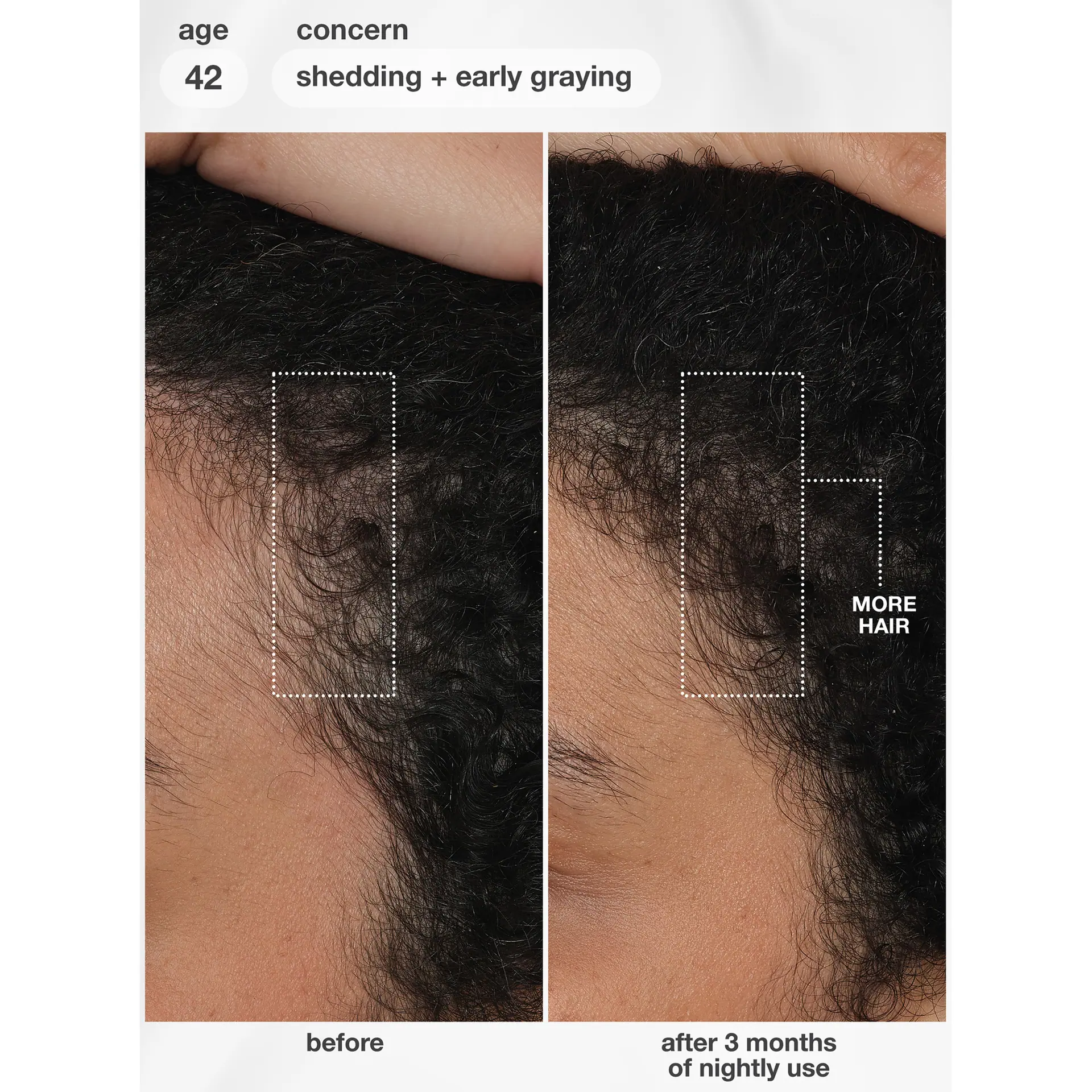 K18 Future IQ Biomimetic Hair Longevity Serum 90 mL